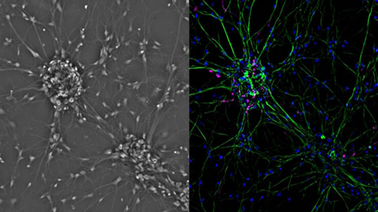 Mammalian cell culure. Phase contrast and fluorescence image. Mammalian cell culure. Phase contrast and fluorescence image.