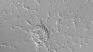 Neurons imaged with DIC contrast.