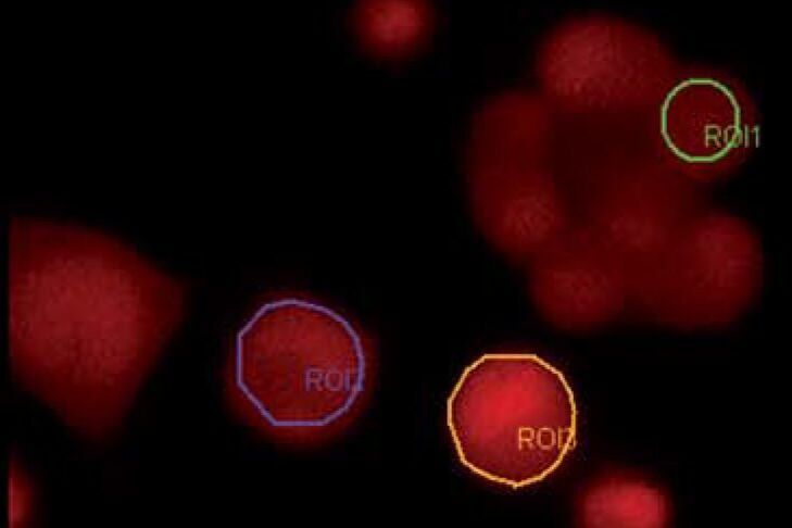 Eukaryotic cells Widefield_Application_Letter_Fura_01_Sep07_en-1.jpg