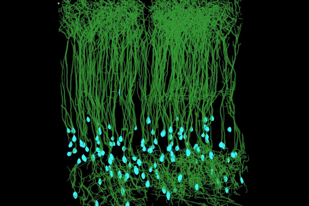 [Translate to chinese:] Aivia_Neuroscience-VBE comparison mouse-1_traced_ROI Accelerating_Neuron_Image_Analysis_with_Automation_teaser.jpg