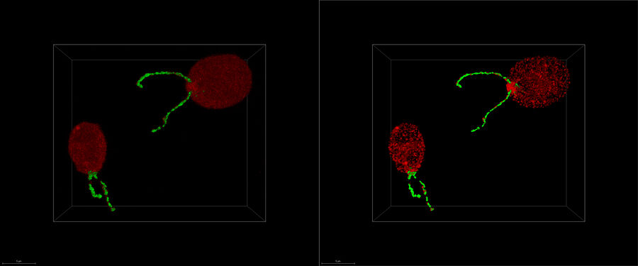 Chlamydomonas reinhardtii, two different types of intraflagellar transport proteins, IFT-NeonGreen and IFT-mCherry. Samples kindly provided by the Pigino-Lab, Max-Planck Institute of Molecular Cell Biology and Genetics, Dresden, Germany.