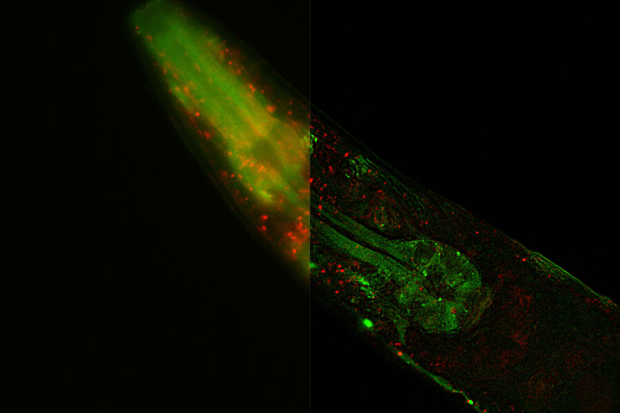 菌株MAH215（Chang等人，Elife，2017）是一种双荧光mCherry::GFP::LGG-1蛋白，通过可视化自噬体（APs）以及自溶酶体（ALs）来监测秀丽隐杆线虫的自噬通量。绿色点状物（GFP）是自噬体，而自噬体在酸性环境中会淬灭 GFP，只发出 mCherry 信号。图片由美国宾夕法尼亚州匹兹堡大学 Aditi U. Gurkar 博士提供