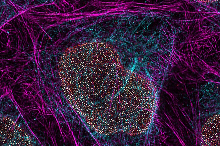 STED细胞生物学：多色固定样品TauSTED Xtend 775；Vimentin AF 594（青色），鬼笔环肽ATTO 647N（洋红色）和NUP107 CF680R（金色）。使用单一损耗谱线在低STED功率下进行三色STED成像。样品由德国慕尼黑路德维希-马克西米利安大学生物医学中心生物影像核心设施的Brigitte Bergner、Mariano Gonzales Pisfil、Steffen Dietzel提供。