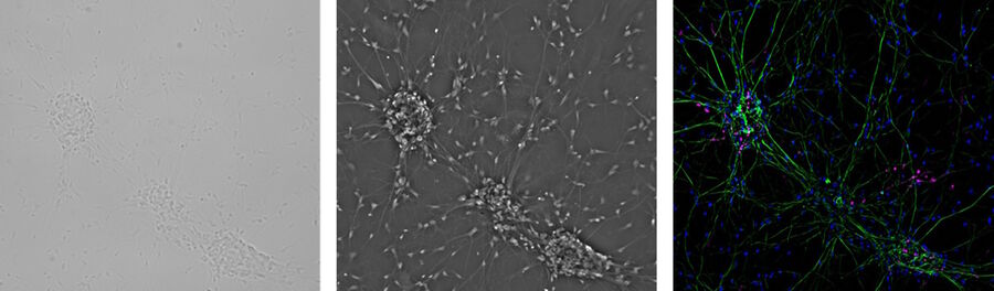 Mammalian cells show a low intrinsic contrast. Therefore, simple brightfield microscopy (left) is often not sufficient for their observation. Contrast methods such as phase contrast (middle) enable clear visualization. For fluorescence microscopy (right), the cells have to be transfected with fluorescent markers prior to imaging. 