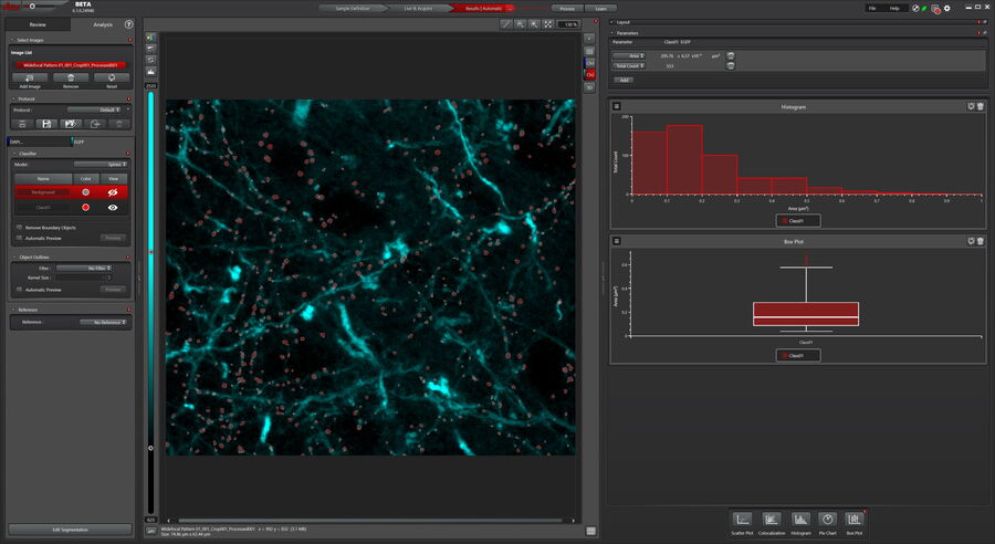 [Translate to chinese:] Analysis of brain slide image_Mica