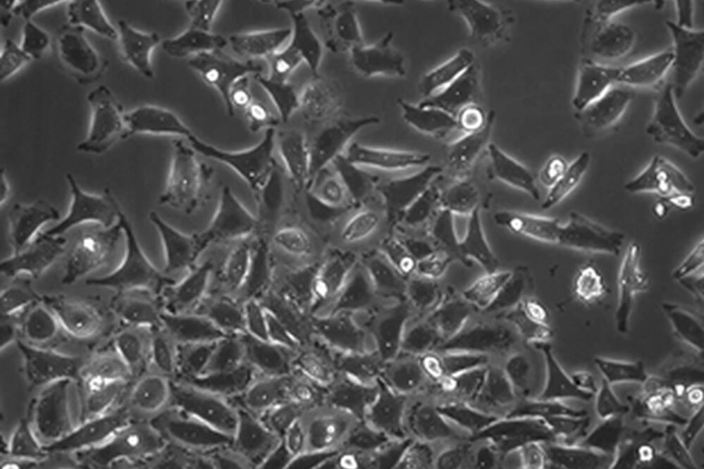 哺乳动物细胞培养的介绍 显微镜知识库 徕卡显微系统