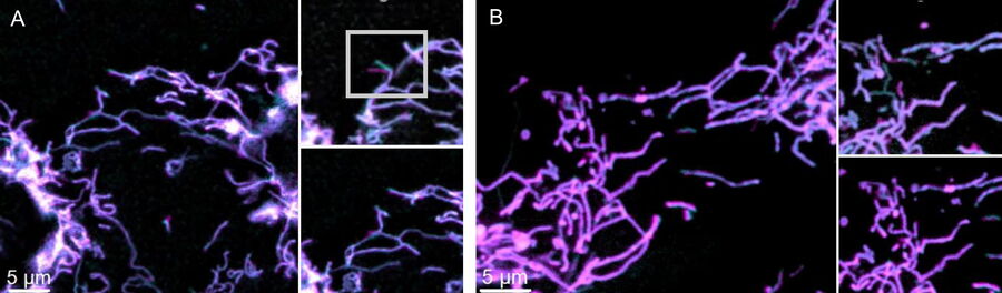 [Translate to chinese:] Images of U2OS cells widefield vs Mica