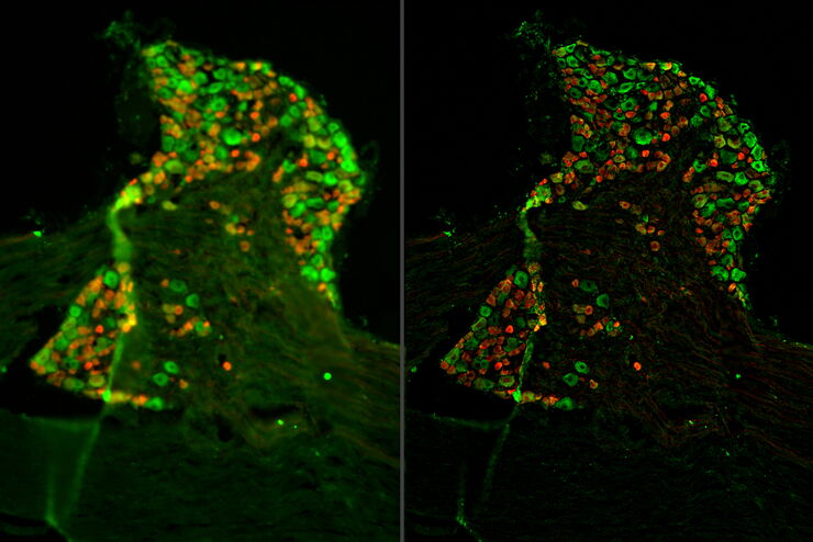 Raw widefield and THUNDER image of a mouse dorsal root ganglion with tdTomato (red) expressed in the sensory neurons. Raw widefield and THUNDER image of a mouse dorsal root ganglion with tdTomato (red) expressed in the sensory neurons.