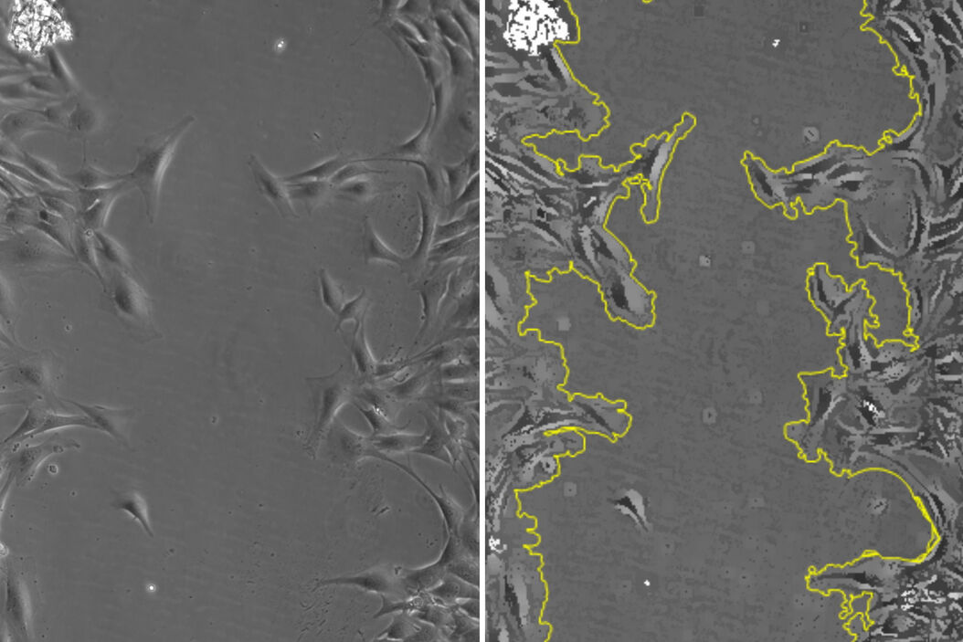 [Translate to chinese:] Images of smooth muscle cells during wound healing. Courtesy L.S. Shankman, Ph.D., University of Virginia. Smooth_muscle_cells_during_.jpg