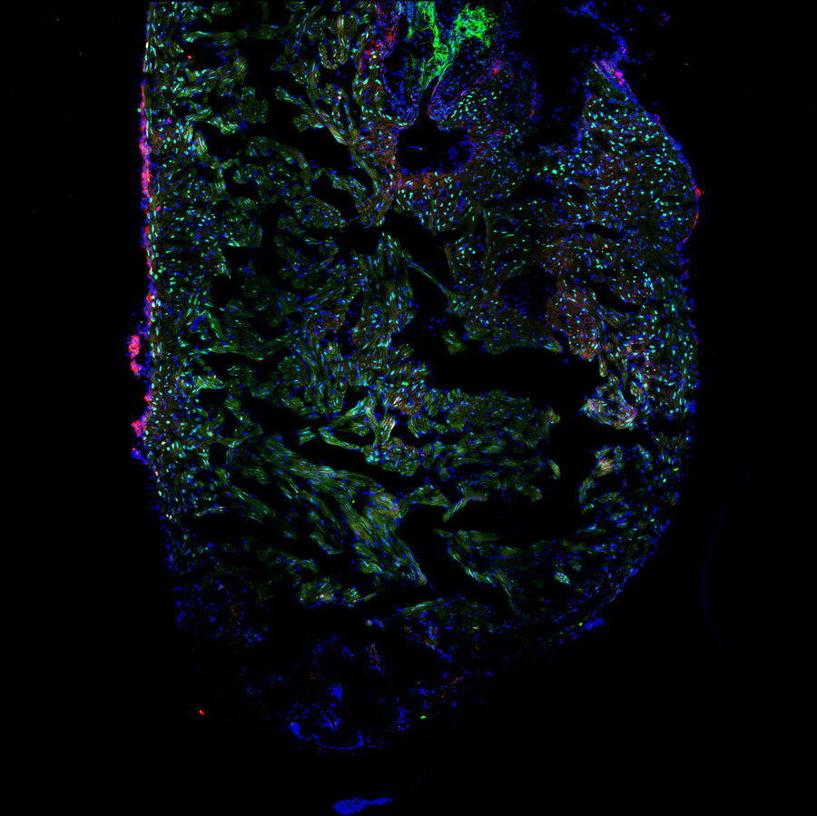 取自斑马鱼心脏的单层切片显示，心室的下部区域有损伤。图像显示了所有细胞的细胞核（蓝色），心肌细胞的细胞核（心肌细胞，绿色）和增殖细胞的细胞核（红色）。图片由马克斯-普朗克心肺研究所的Laura Peces-Barba Castaño提供。