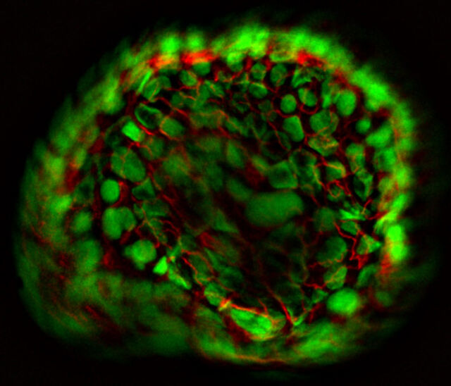 使用 THUNDER Imager Model Organism 的类器官 Z 轴层切扫描 使用 THUNDER Imager Model Organism 的类器官 Z 轴层切扫描