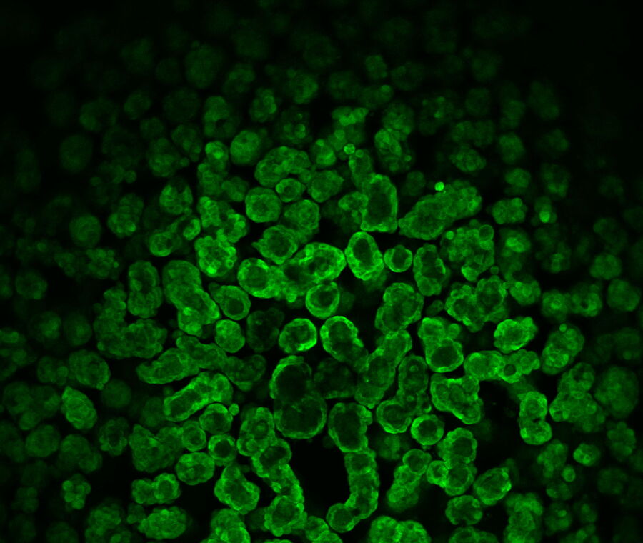 对第14天的囊肿进行预览