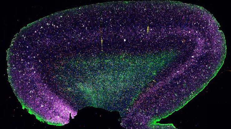 Adult human Alzheimer’s brain demonstrating a panel of 15 markers. Adult human Alzheimer’s brain demonstrating a panel of 15 markers.