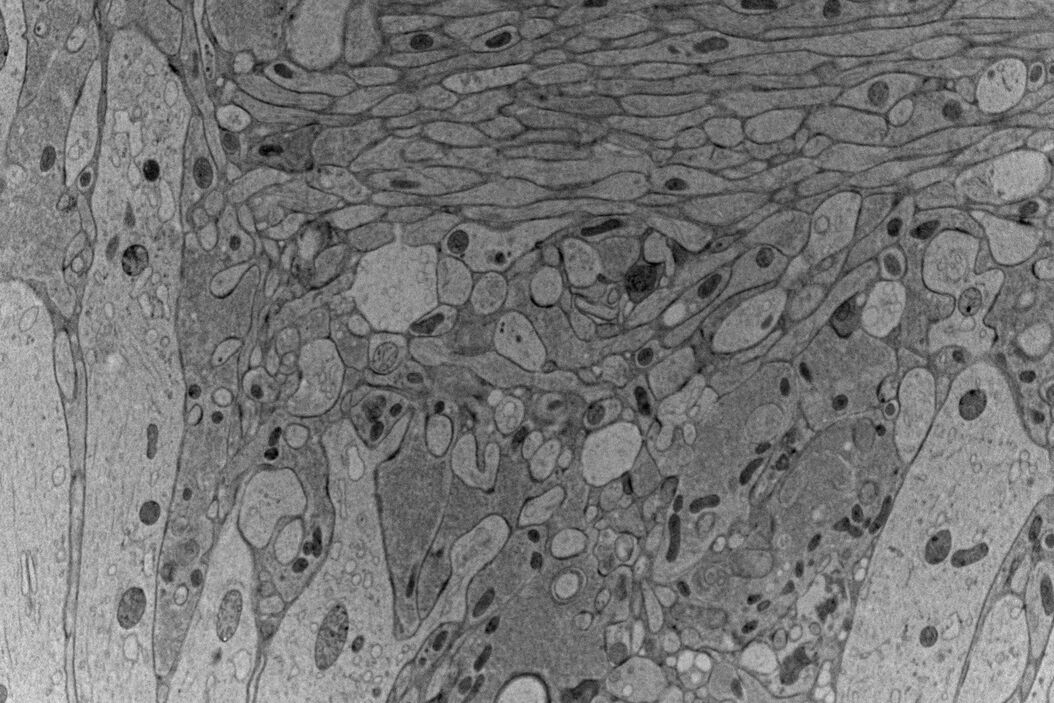  High-pressure_freezing_Revealing_functional_mechanisms.jpg