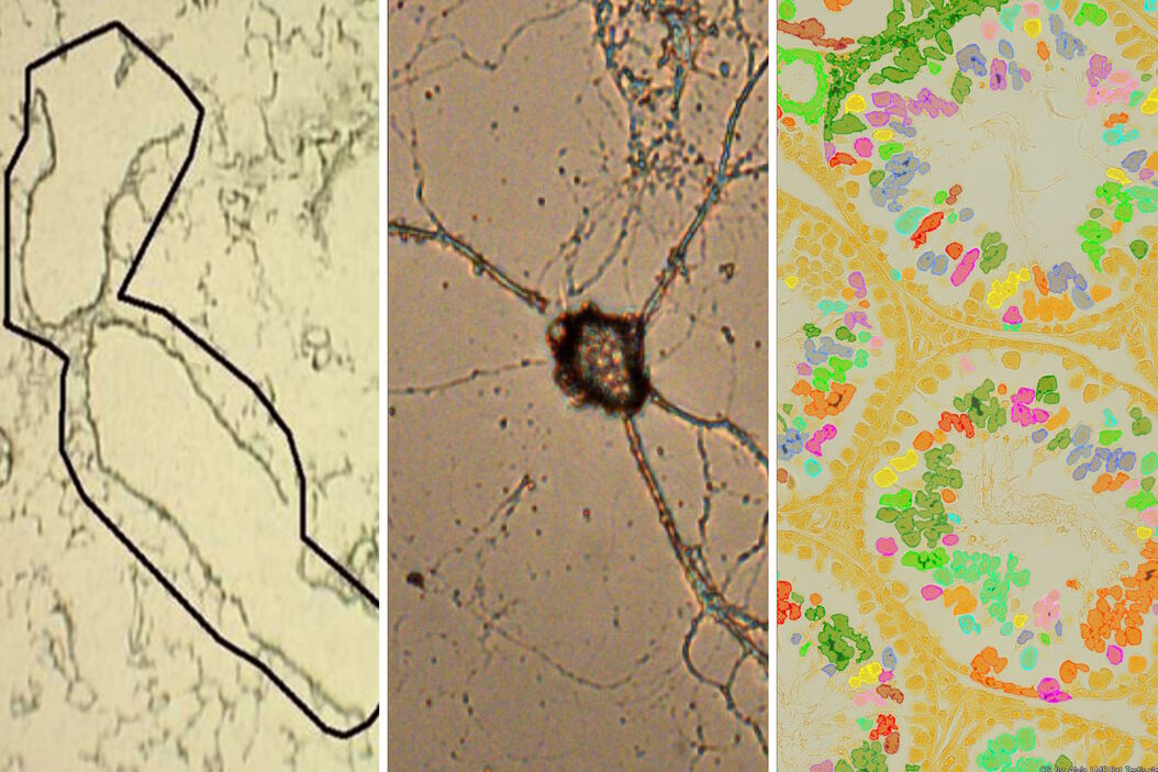  LMD_Protocols_for_Tissue_and_Cell_Isolation_teaser.jpg