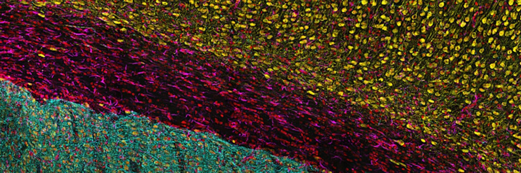 徕卡显微系统公司在伦敦帝国学院展示THUNDER Imager Cell转盘共聚焦