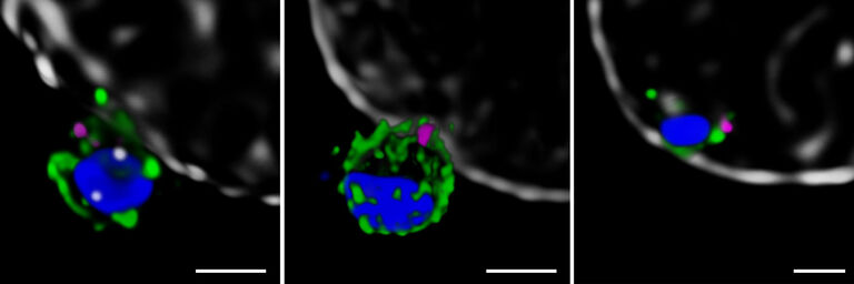 STED 用于疟疾研究： 3D STED 775 能够揭示裂殖体侵入红细胞的机制。 图像显示了 RON4（紫色）与蛋白 PfRh5（左侧，绿色）、PfRipr（中间，绿色）、PfCyRPA（右侧，绿色）的叠加。 蓝色是细胞核，灰色是红细胞膜。 比例尺： 1微米。 图片由澳大利亚沃尔特和伊丽莎·霍尔医学研究所的 Jennifer Volz 和 Alan Cowman 以及德国欧洲分子生物学实验室的 Marko Lampe 提供。