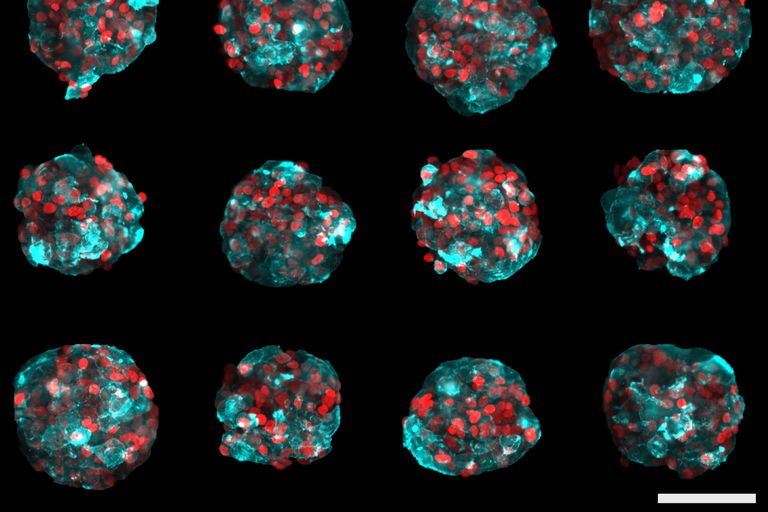 由表达 LifeAct RFP（青色）和 H2B GFP（红色）的 T47D 细胞系生成的固定细胞团。图中为多位置成像实验的快照。比例尺100µm：