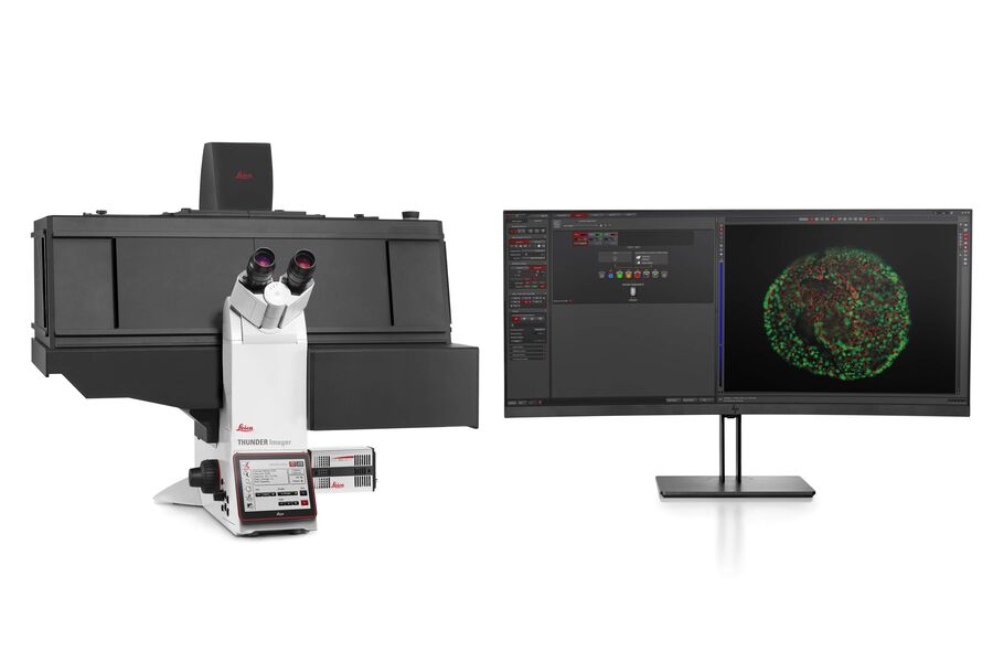 THUNDER Imager Live Cell with incubator. The cage incubator (transparent, black or as laser-safe variant) for warm air incubation and optional CO2-control covers the entire microscope.