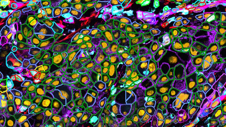 [Translate to chinese:] Cell counts for each biomarker were divided by total number of cells to give a percentage of biomarker positive cells out of total cells for each biomarker.