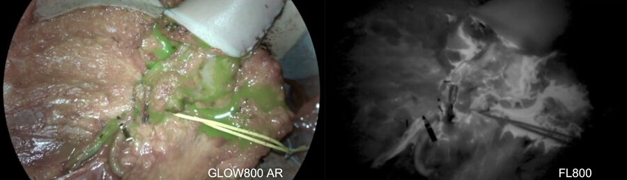 [Translate to chinese:] Inspecting blood flow_ICG fluorescence camera GLOW 800 & florescence-aided angiography FL800