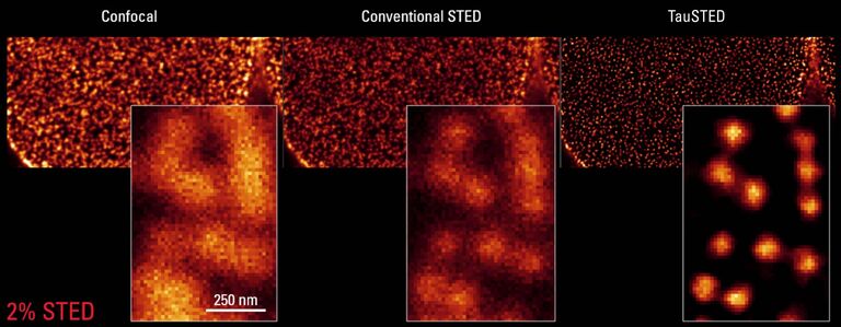 STED 用于细胞生物学： TauSTED 660 可揭示核孔（NPC）在 COS7 细胞中的分布，实验用 AF555 标记Nup 复合物 。 只需2%的 STED 光即可显示出更多细节。 一抗 mAb414 可识别核孔篮的几个核孔蛋白并形成点状染色。