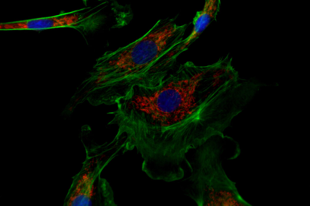  Upright_Fluorescence_Microscopy_for_Virus_Replication_Studies_SemrockSlide.jpg