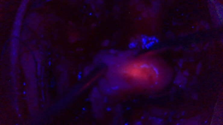 [Translate to chinese:] Tumor resection leveraging 5-ALA fluorescence. Image courtesy of Dr. Carla Reizinho.