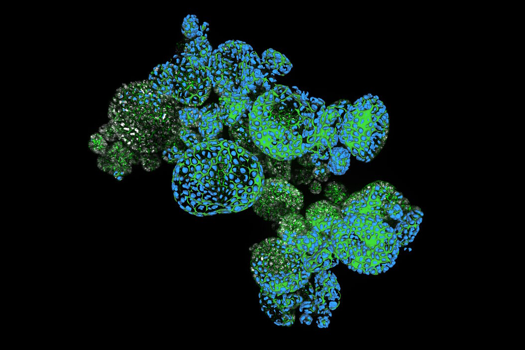 [Translate to chinese:] Dapi – Nucleus, GFP – Plasma Membrane, Thickness 100µm, 63x objektive, 469 Z planes, 2 channels, THUNDER Imager 3D Cell Culture. Courtesy M.Sc. Dana Krauß, Medical University of Vienna (Austria). Two_color_organoid_cluster.jpg