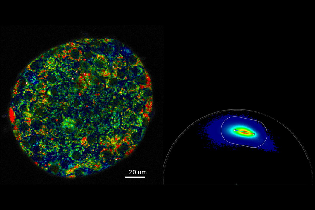 Metabolic imaging of mouse pancreatic islet. Phasor_FLIM_detects_metabolic_differences_teaser.jpg