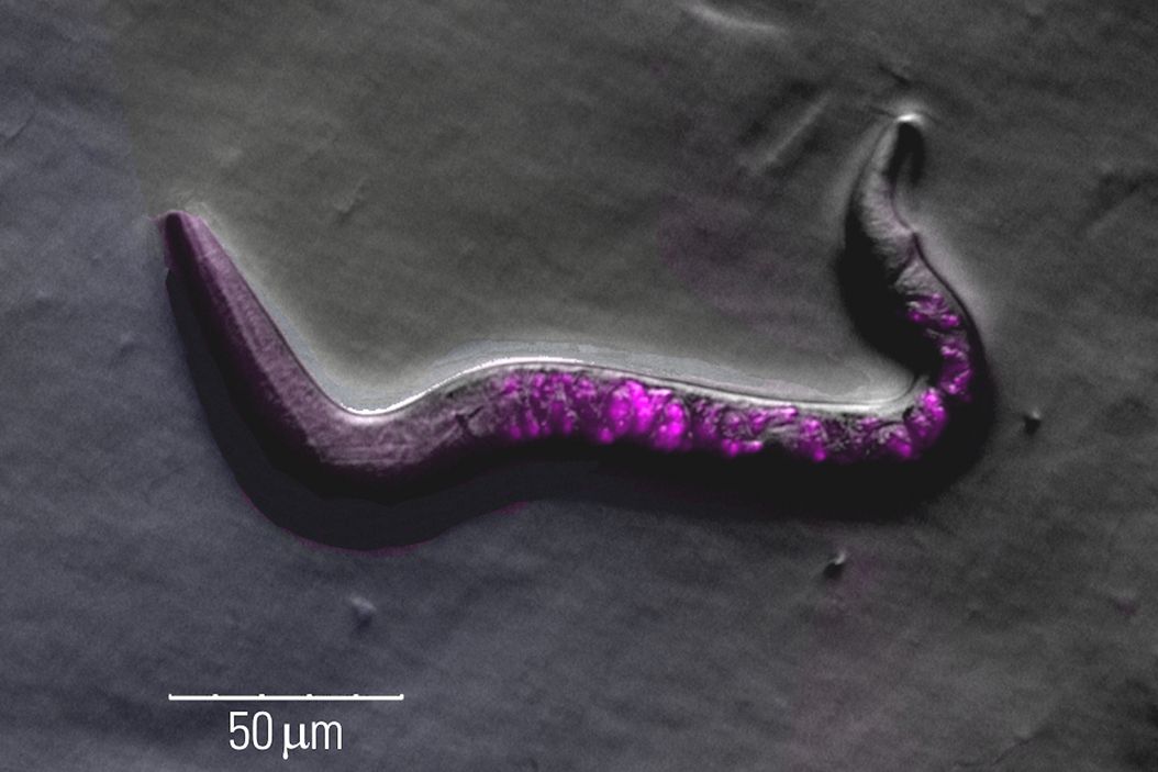 Image of roundworm C. elegans acquired with a M205 FA fluorescence automated stereo microscope in combination with Rottermann contrast. Areas labelled with mCherry are seen as reddish purple. Roundworm_C_elegans_M205_FA_Rottermann_contrast.jpg