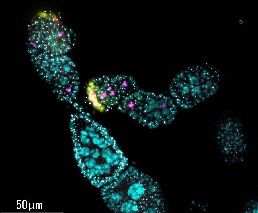 [Translate to chinese:] Maximum projection image of early prophase stage Drosophila germarium after ICC