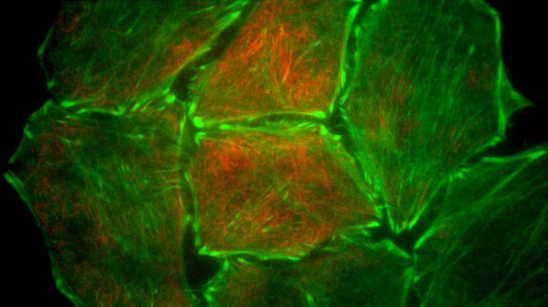 使用 SIR-Tubulin 染色，稳定表达 Actin Chromobody-Tag GFP2 的 Hela 细胞。来源：ChromoTek GmbH, Munich, Germany, and Spirochrome SA.