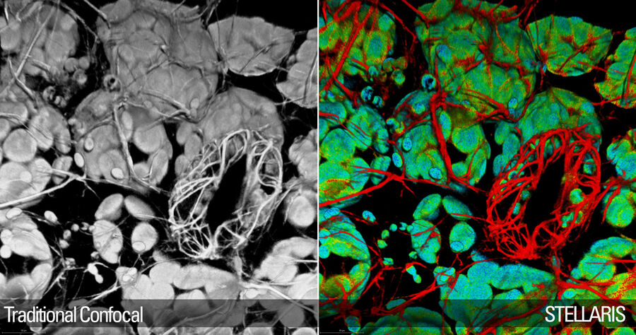 带气孔的拟南芥叶。 肌动蛋白： 红色，Lifeact-Venus（Era等人，《Plant Cell Physiol》杂志，2009 年）；叶绿体： 绿色，内源荧光。 使用TauContrast成像。 样本由海德堡大学生物研究中心的Melanie Krebs博士提供