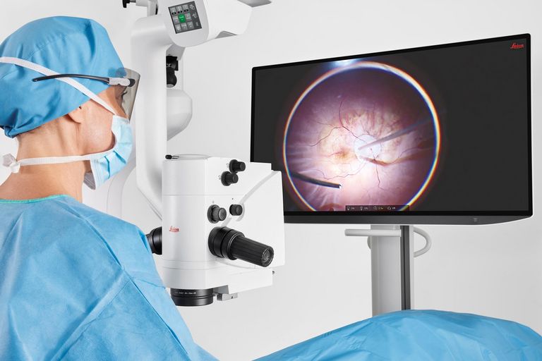 利用 55 英寸 3D 4K 显示器进行视网膜手术的 3D 平视法