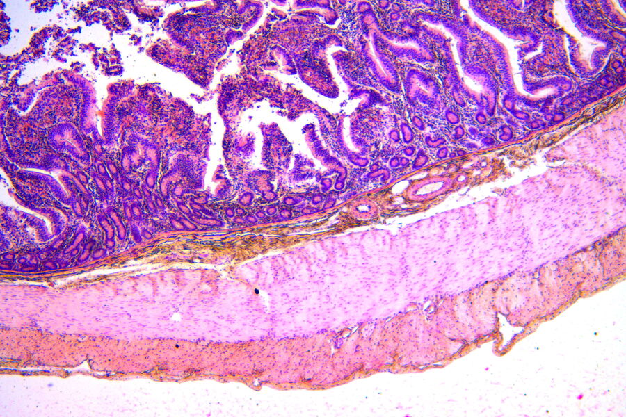 [Translate to chinese:] This 40x magnification of a duodenum shows the boundary between the submucosal and mucosal regions