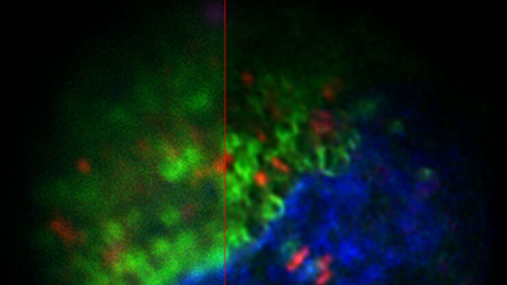 Projection of a confocal z-stack. Sum159 cells, human breast cancer cells kindly provided by Ievgeniia Zagoriy, Mahamid Group, EMBL Heidelberg, Germany. Blue–Hoechst - indicates nuclei, Green–MitoTracker mitochondria, and red–Bodipy - lipid droplets