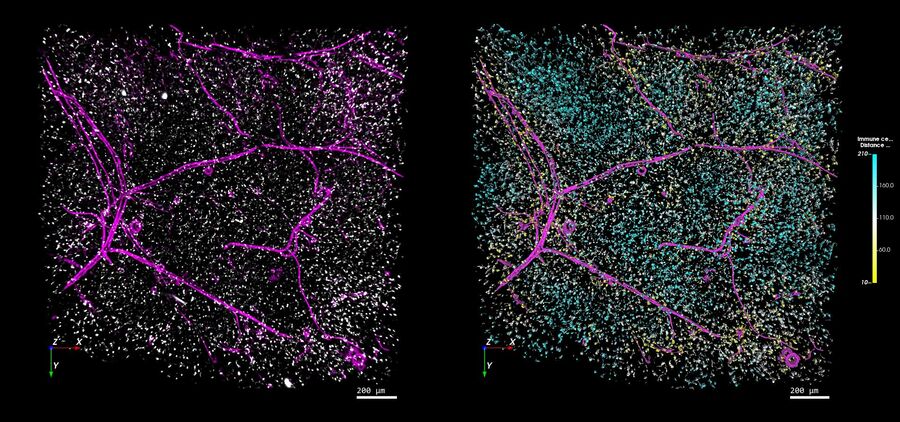 左图：免疫系统（白色）和血管（粉色）在白色脂肪组织中的分布（图像使用THUNDER Imager 3D Cell Culture拍摄）。右图：使用Aivia进行自动化分析后的相同图像，根据与最近的血管之间的距离对每个免疫细胞进行了颜色编码。图像由德国慕尼黑的Selina Keppler博士提供。