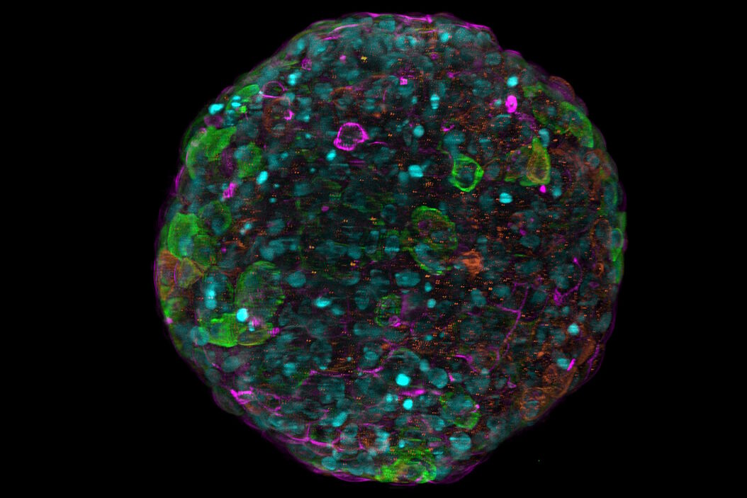 [Translate to chinese:] Spheroid stained with Cyan: Dapi nuclear countertain; Green AF488 Involucrin; Orange AF55 Phalloidin Actin; Magenta AF647 CK14. Spheroid_stained_with_Cyan_4color_overlay.jpg