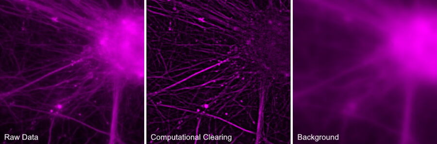 Beta III Tubulin Rat Neuronal Cells labeled with Cy5