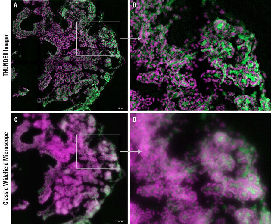 图 1：图示为胚胎小鼠胰腺外植体（E15.5）图像。细胞核（DAPI，品红色）和细胞骨架（phalloidin-488，绿色）均有标记。A+C 对比 "THUNDER 后"（A）和 "THUNDER 前"（C）的数据，可清楚地看到单个图像平面的对比度增强。B+C 20 微米厚胰腺切片的放大图。