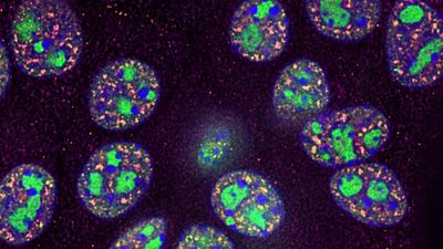 Immortalised mouse pancreatic epithelial cells labelled with DAPI (shown in blue), JF azide dye (shown in green), Alexa 647 (shown in pink) and A555 (shown in yellow) to stain various RNA bio-genesis sub nuclear compartments, here mainly nucleoli (rRNA synthesis) and nuclear speckles (RNA splicing regulatory units). Image acquired using a 100x oil immersion objective on the THUNDER Imager Cell, without (left) and with (right) THUNDER computational clearing applied. Courtesy of Dr. Zeinab Rekad, Department of Biochemistry, University of Oxford.