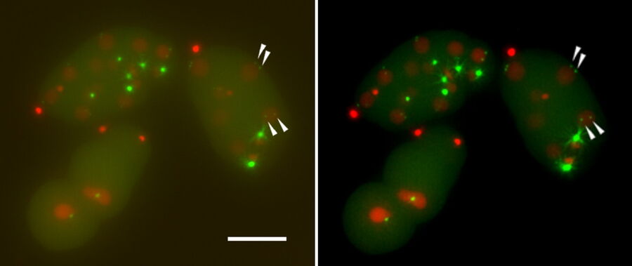 表达中心粒标记 SPD5-GFP 的秀丽隐杆线虫细胞（绿色）和可视化细胞核的组蛋白 2B- Cherry（红色）。