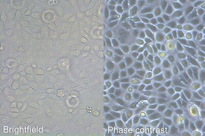 [Translate to chinese:] Comparison of brightfield and phase-contrast images of MDCK cells