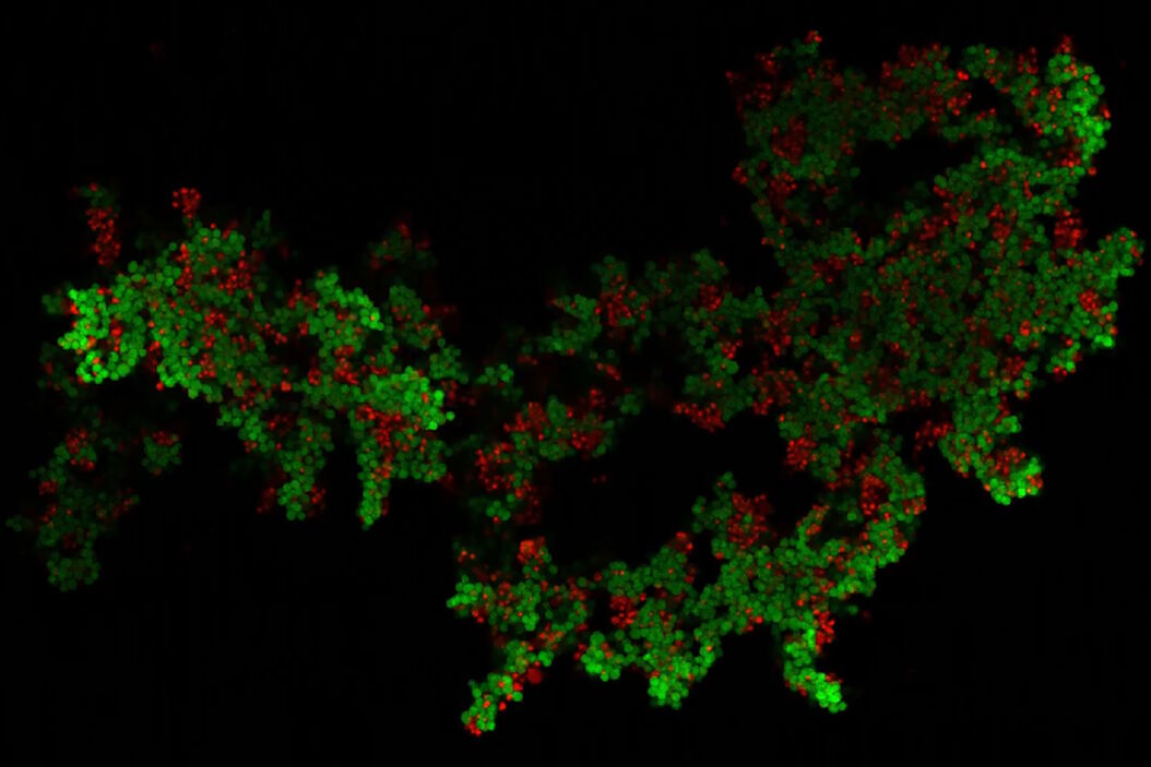 使用 Mica 的共聚焦模式对卵巢癌细胞进行三维培养成像。 3D_culture_of_ovarian_cancer_cells.jpg