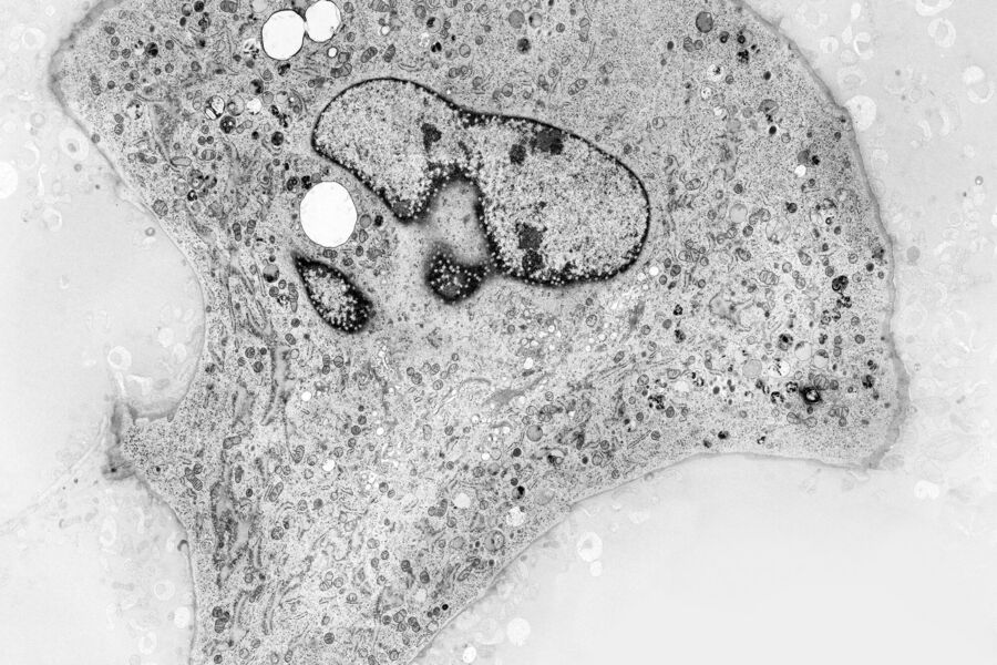 图1：生长在蓝宝石片上的小鼠胚胎纤维原细胞（由英国布里斯托大学，Verkade P提供）。