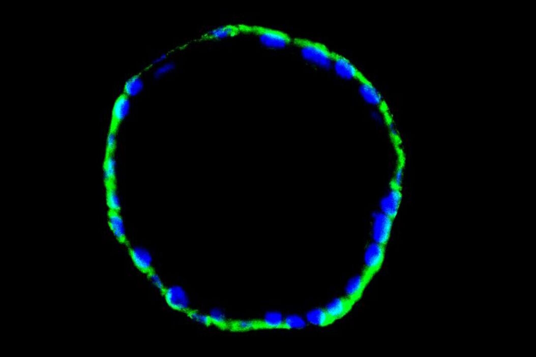 小鼠子宫内膜类器官的免疫荧光图像（CK14 和 DAPI 染色） Immunofluorescence_image_of_a_mouse_enodmetrial_organoid_stained_with_CK14_and_DAPI.jpg