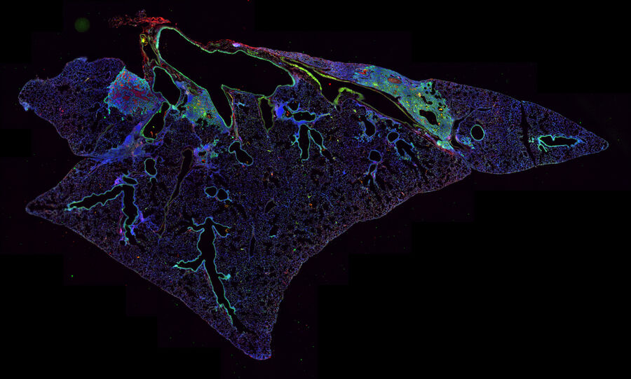 图2： 免疫荧光，角蛋白-5（绿色），PDL-1（红色）：小鼠肺切片，接种Puerto Rico 8流感病毒毒株诱导肺上皮损伤。感谢Cedars-Sinai医疗中心Andrew Beppu提供图片。