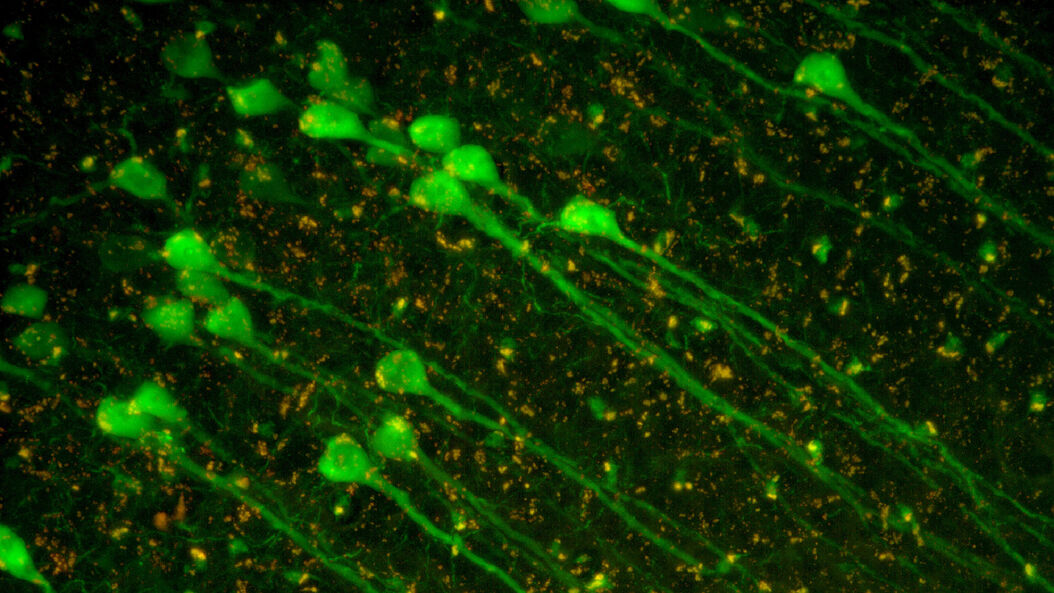  Neuroscience-Solutions-Res-.jpg