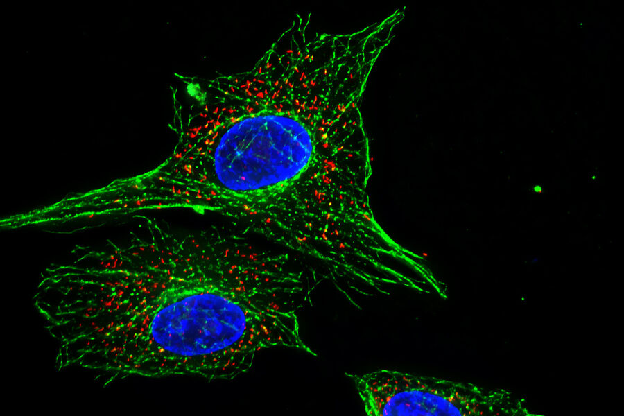  图1：荧光显微镜下显示的荧光标记细胞。